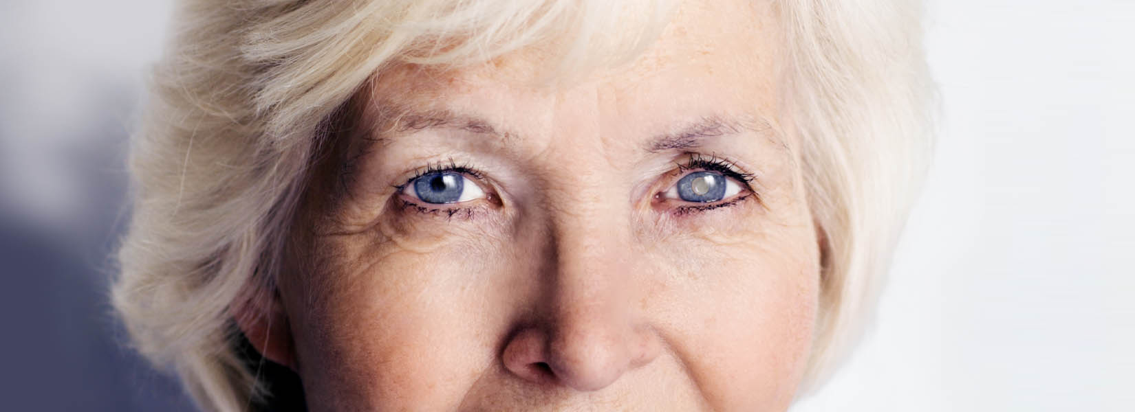 Cataract Surgery in Bessemer